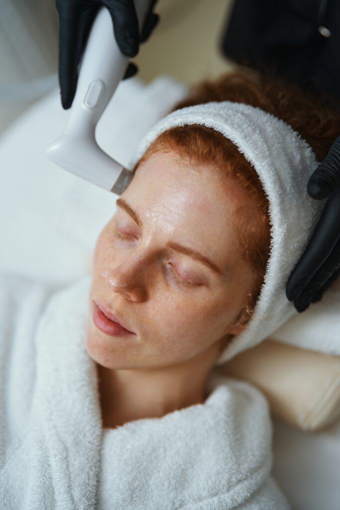 Pacjentka podczas usuwania laserowo blizn potrądzikowych.