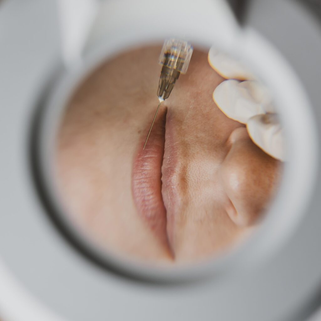 Zbliżenie na profesjonalny zabieg modelowania ust.