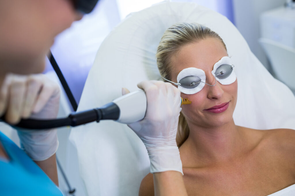 Klientka podczas profesjonalnego zabiegu usuwania przebarwień laserem. Zabiegi z użyciem lasera powinny być stosowane tylko pod okiem doświadczonej specjalistki z medycyny estetycznej.